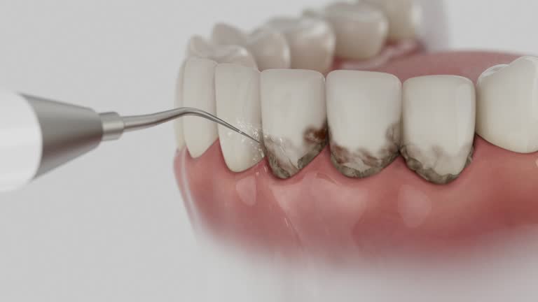 Reliable Dental contractor in Caledonia, MS by Smile Center Dentistry